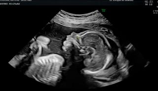 test adn fetal lima Vientre Materno Perú