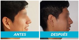 clinicas otoplastia lima Cirugia Estética y Plástica Mendez