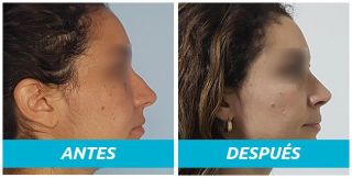 clinicas otoplastia lima Cirugia Estética y Plástica Mendez