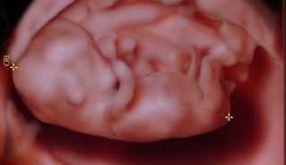 test adn fetal lima Vientre Materno Perú