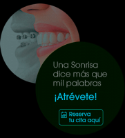 Ortodoncia sin brackets, Ortodoncia Perú, Ortodoncia Lima, Smile Perú, Ortognática Peru,Ortodoncia estética