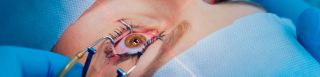 clinicas operacion miopia lima Clínica de Ojos Oculaser