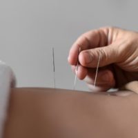 terapias neurales lima Centro Osteopatico Vida